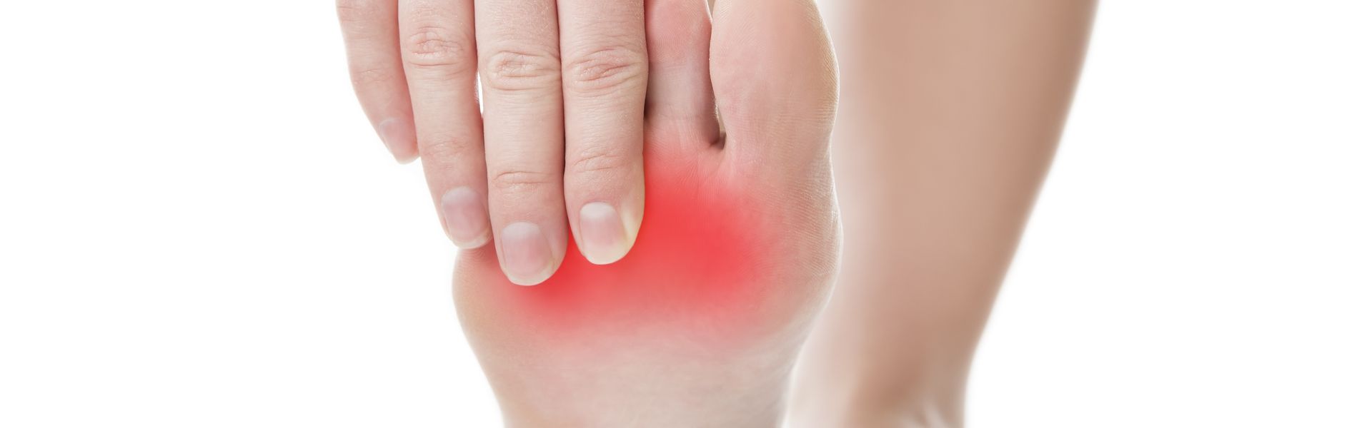 Neuroma de Morton