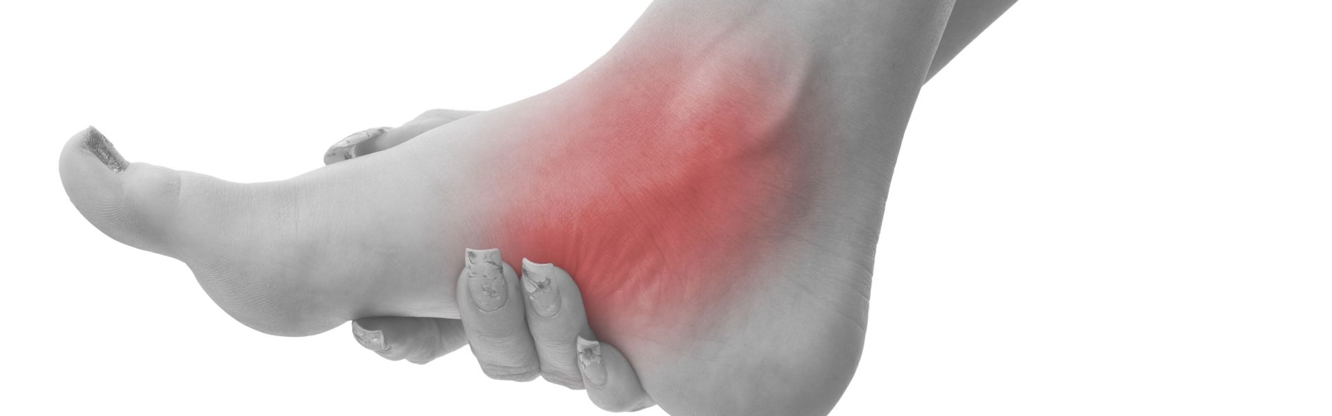 Tendiditis del tibial posterior